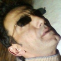 ---